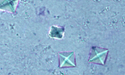 Urinary crystals under a microscope
