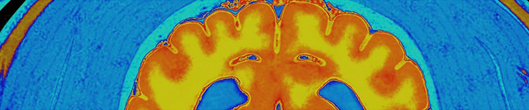 purina institute changes in aging brain