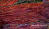 muscle tissue