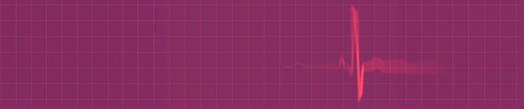 ecocardiograma
