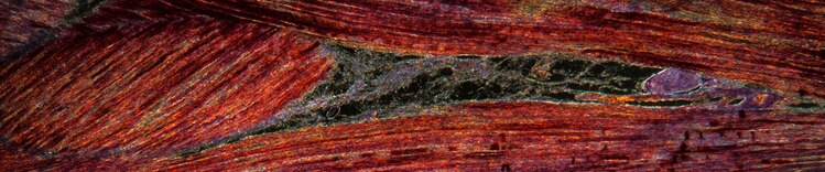 tecido muscular