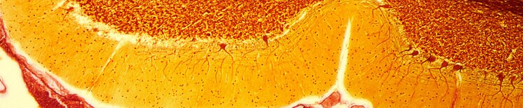 aging-brain