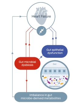 heart failure diagram