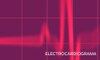 electrocardiograma