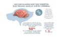 Les convulsions sont des tempêtes électriques dans le cortex cérébral